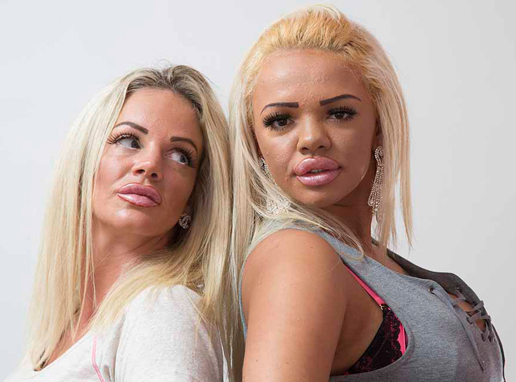 Mother Daughter Plastic Surgery, Kayla, Georgina, Katie Price Mother Daughter Plastic Surgery, Kayla, Georgina, Katie Price